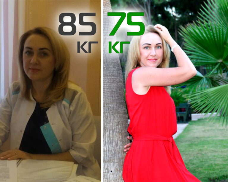Татьяна, до и после